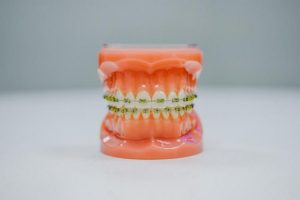 photo 1619987614890 4797e713fb03cropentropycstinysrgbfitmaxfmjpgixidMnwxNDA1NTd8MHwxfHNlYXJjaHw0OXx8ZGVudGlzdHxlbnwxfDB8fHwxNjY5NDg3NjE2ixlibrb 4.0.3q80w1080